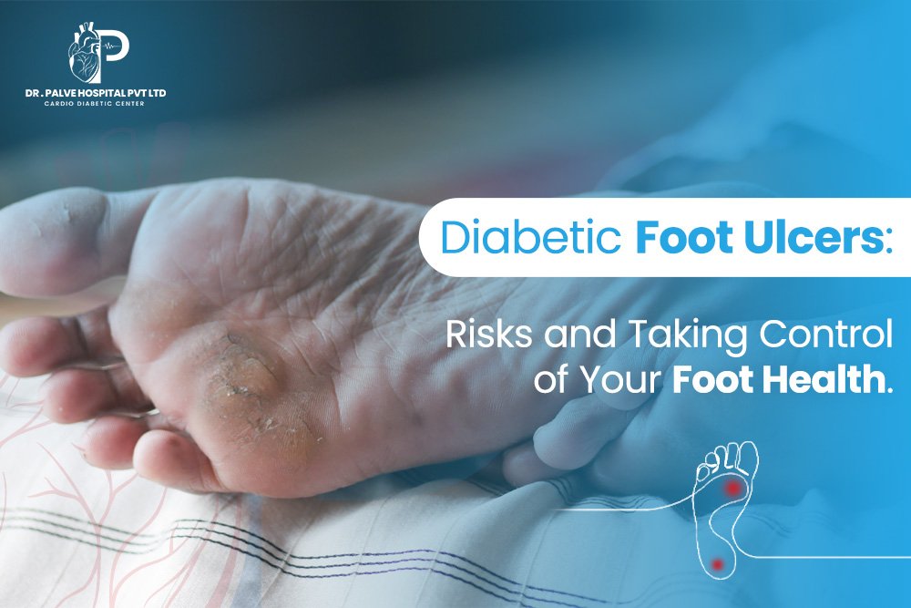 diabetic foot ulcers treatment
